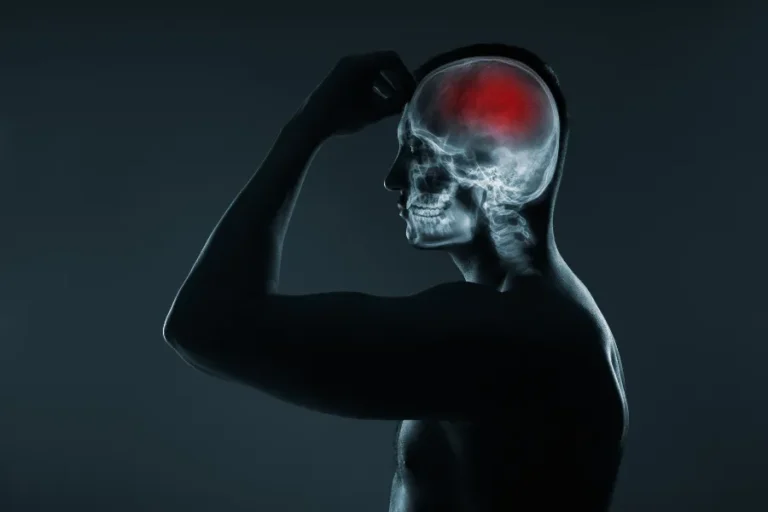 Image of xray with lit of skull